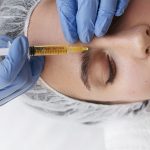 کربوکسی تراپی صورت و دور چشم