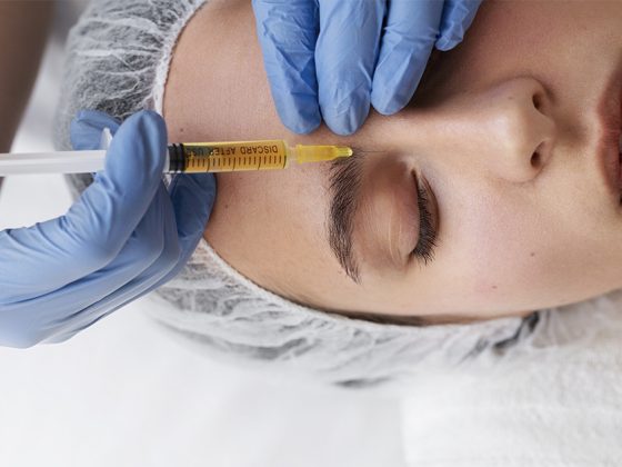 کربوکسی تراپی صورت و دور چشم